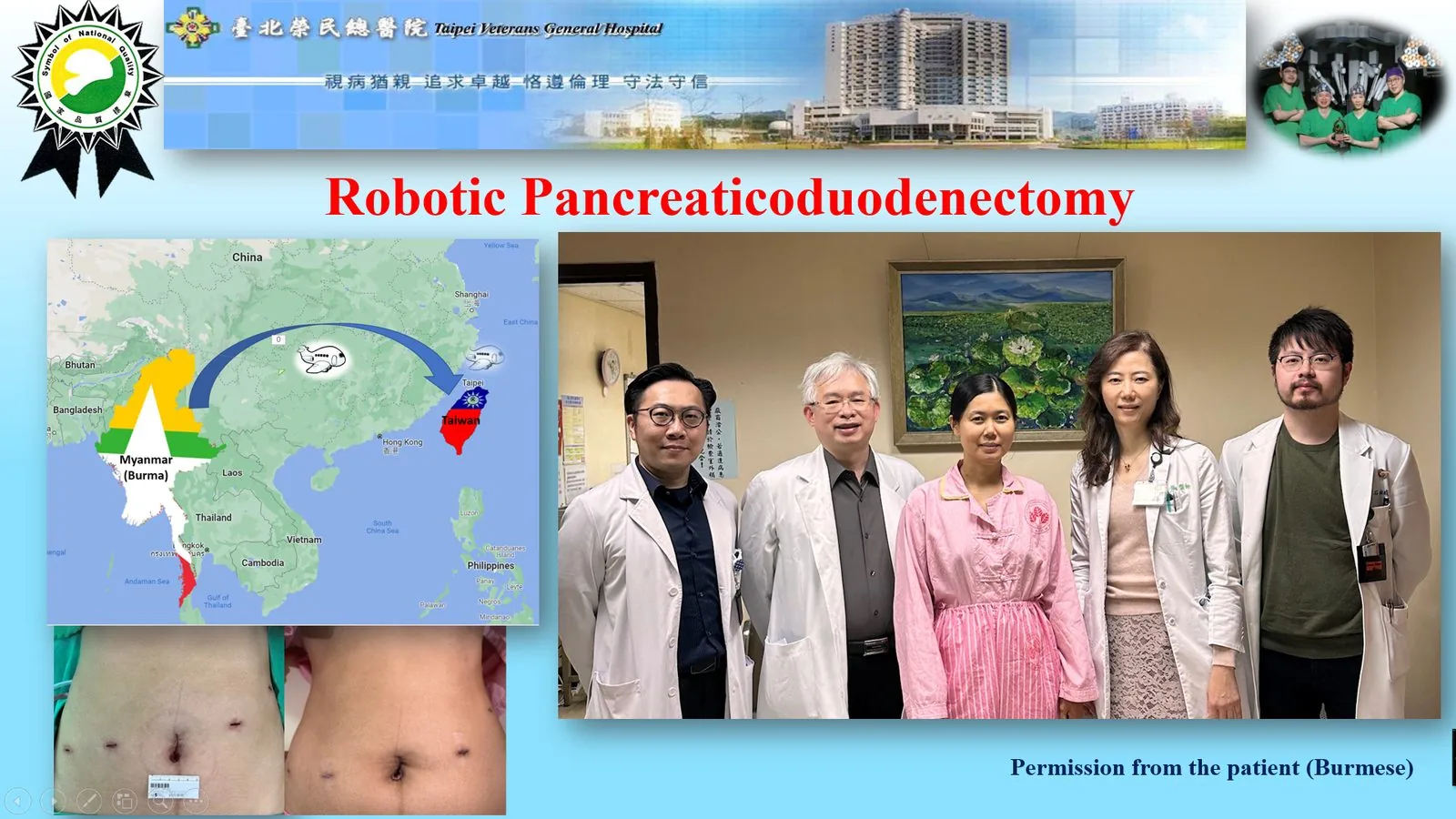 Minimally Invasive Robotic Pancreatic Surgery - Small Wound for Major Pancreatic Surgery