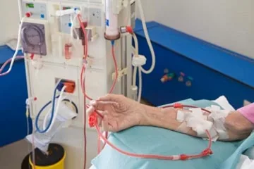 Plasmapheresis